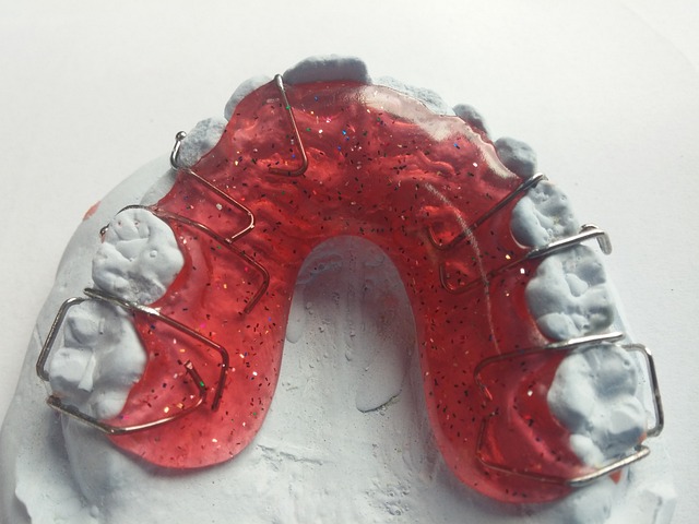 Пластинки для выравнивания зубов Томск Проектируемый стоматология харизма томск